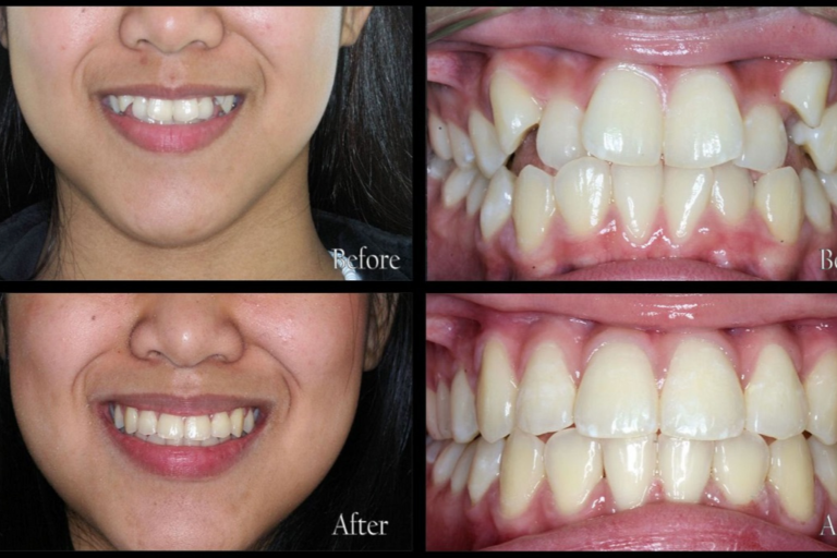 Orthodontic-Patient