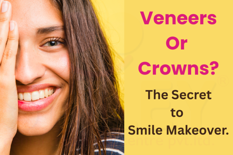 Veneers or Crowns - Which is Better for a Smile Makeover
