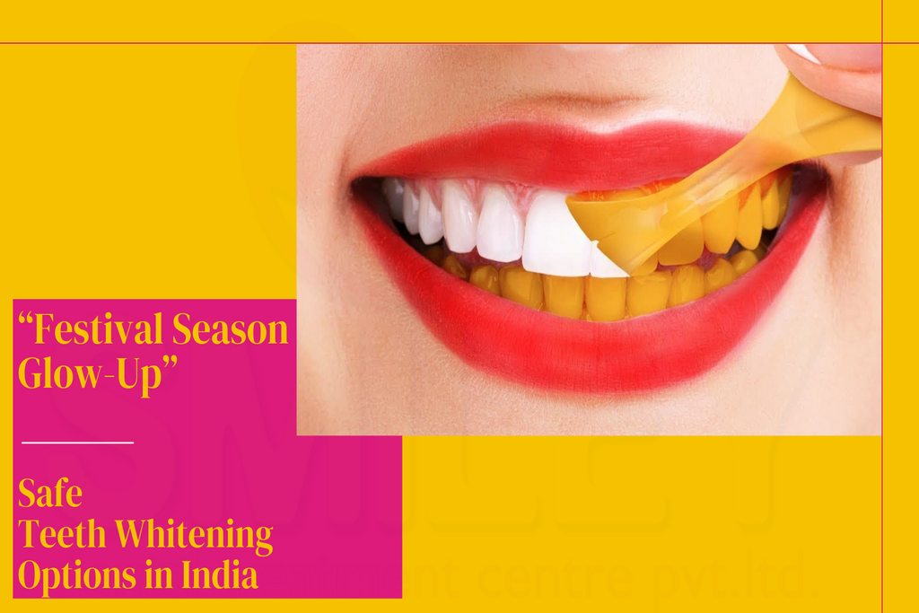 Festival Season Glow-Up – Safe Teeth Whitening Options in India